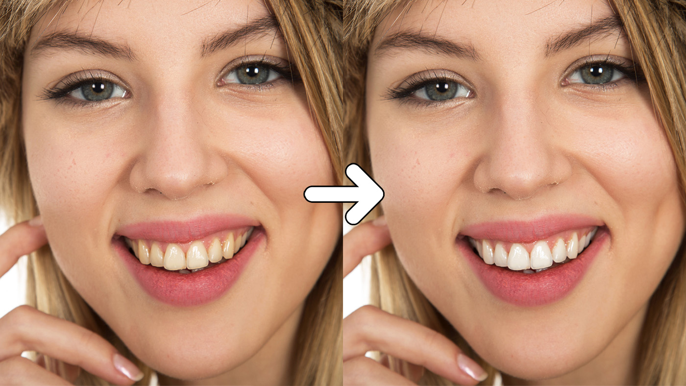 Quick method to whiten teeth in Lightroom Edit with Kim